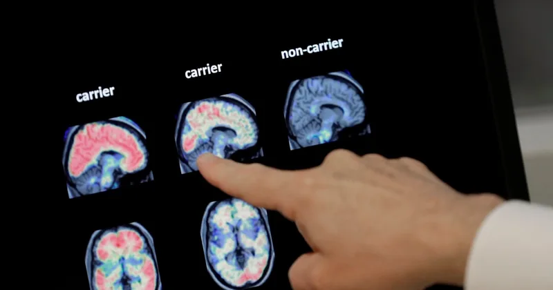 How to Lower Your Risk of Dementia Starting in Middle Age
