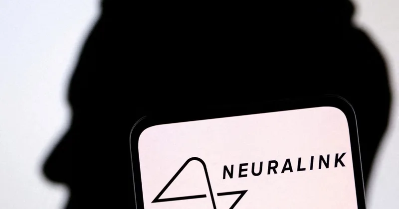 Musk: Third Person Receives Computer-Brain Connection from Neuralink