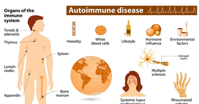 Autoimmune Diseases Affect More Women than Men