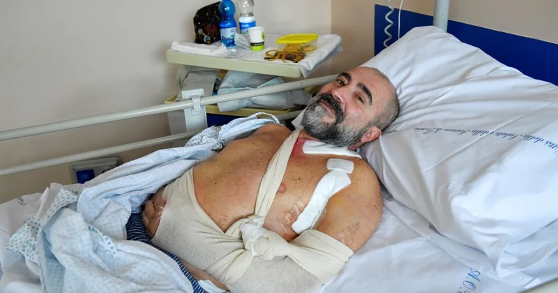 Italian Man Might Regain Use of Hand after Nerve Operation