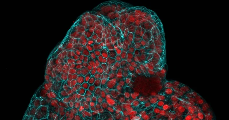 Scientists Grow Mini-Organs in Cells from Pregnancy Fluid
