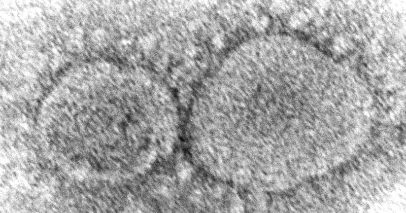 Study: Past COVID Infection Could Protect Against Colds